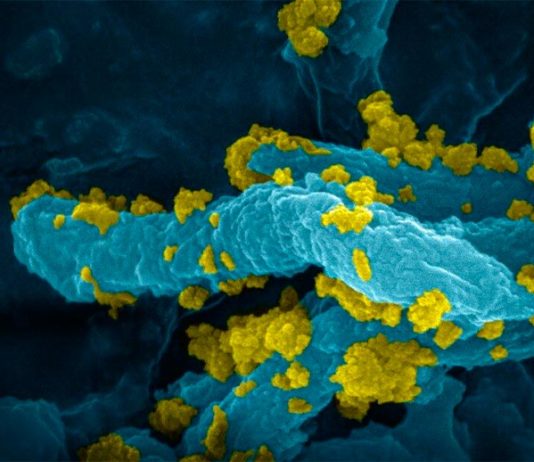 Producen hidrógeno a partir de la luz con bacterias no fotosintéticas Los híbridos de Desulfovibrio desulfuricans-CdS muestran una alta actividad de producción de hidrógeno (H2), una alta estabilidad y una notable eficiencia en el uso directo de la energía solar