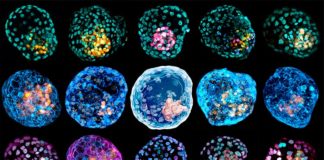Crean un modelo de un embrión humano temprano a partir de células de la piel Imágenes de iBlastoides con diferente tinción celular, para estudiar el embrión humano temprano