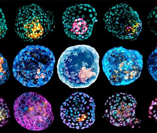 Crean un modelo de un embrión humano temprano a partir de células de la piel Imágenes de iBlastoides con diferente tinción celular, para estudiar el embrión humano temprano