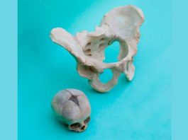 Las diferencias entre sexos de la pelvis humana se heredaron de ancestros mamíferos Fotografía de una pelvis humana femenina y el cráneo de un bebé recién nacido