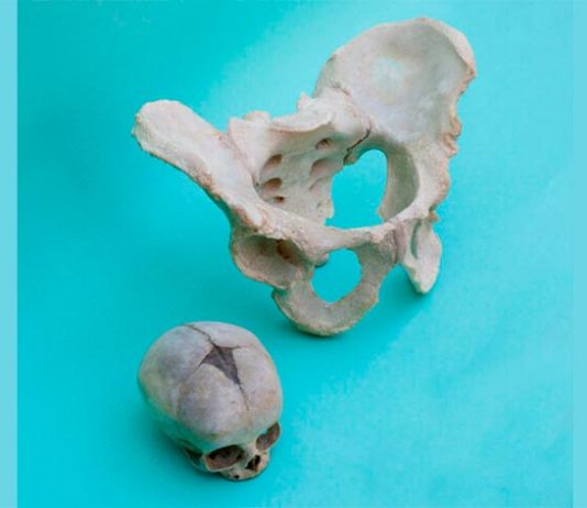 Las diferencias entre sexos de la pelvis humana se heredaron de ancestros mamíferos Fotografía de una pelvis humana femenina y el cráneo de un bebé recién nacido