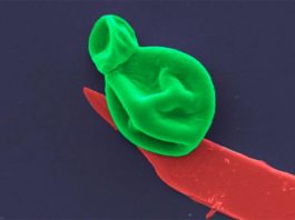 Nanotecnología para destruir superbacterias y células fúngicas (fósforo negro) Una célula fúngica (verde) interactúa con una nanocapa de fósforo negro (rojo)