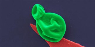 Nanotecnología para destruir superbacterias y células fúngicas (fósforo negro) Una célula fúngica (verde) interactúa con una nanocapa de fósforo negro (rojo)