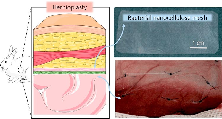 Hernias: pruebas de mallas quirúrgicas de nanocelulosa bacteriana en estudios in vivo para suturar heridas de la pared abdominal en conejos