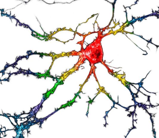 Depresión: Droga de tipo psicodélico sin los efectos secundarios alucinógenos Imagen representativa de neuronas del hipocampo disociadas cultivadas que expresan de forma transitoria psychLight1 y psychLight2