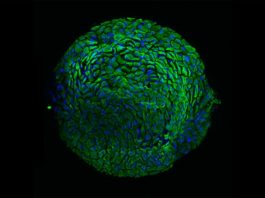 Primer modelo organoide derivado de pacientes para el cáncer de cuello uterino Nuevo modelo de organoide cervical que representa la armadura protectora de la mujer, para estudiar el cáncer de cuello uterino