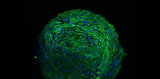 Primer modelo organoide derivado de pacientes para el cáncer de cuello uterino Nuevo modelo de organoide cervical que representa la armadura protectora de la mujer, para estudiar el cáncer de cuello uterino