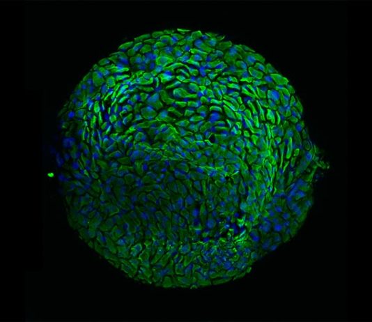Primer modelo organoide derivado de pacientes para el cáncer de cuello uterino Nuevo modelo de organoide cervical que representa la armadura protectora de la mujer, para estudiar el cáncer de cuello uterino