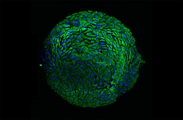 Nuevo modelo de organoide cervical que representa la armadura protectora de la mujer, para estudiar el cáncer de cuello uterino Nuevo modelo de organoide cervical que representa la armadura protectora de la mujer, para estudiar el cáncer de cuello uterino