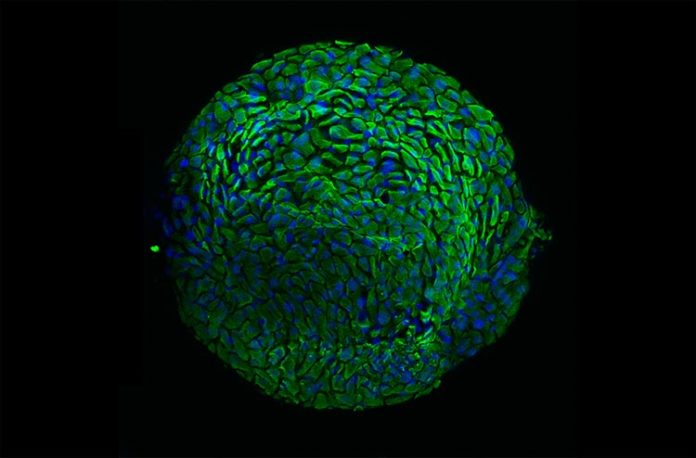 Nuevo modelo de organoide cervical que representa la armadura protectora de la mujer, para estudiar el cáncer de cuello uterino