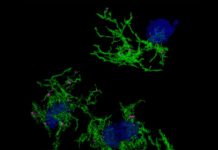 Descubren la firma genética responsable de la microglía que se alimenta de placa en el Alzheimer Imagen microscópica confocal de microglía (verde) que envuelve placas de amiloide (azul) en el Alzheimer