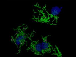 Descubren la firma genética responsable de la microglía que se alimenta de placa en el Alzheimer Imagen microscópica confocal de microglía (verde) que envuelve placas de amiloide (azul) en el Alzheimer