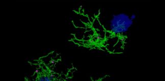 Descubren la firma genética responsable de la microglía que se alimenta de placa en el Alzheimer Imagen microscópica confocal de microglía (verde) que envuelve placas de amiloide (azul) en el Alzheimer