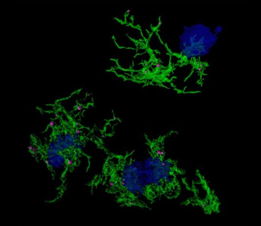 Descubren la firma genética responsable de la microglía que se alimenta de placa en el Alzheimer Imagen microscópica confocal de microglía (verde) que envuelve placas de amiloide (azul) en el Alzheimer