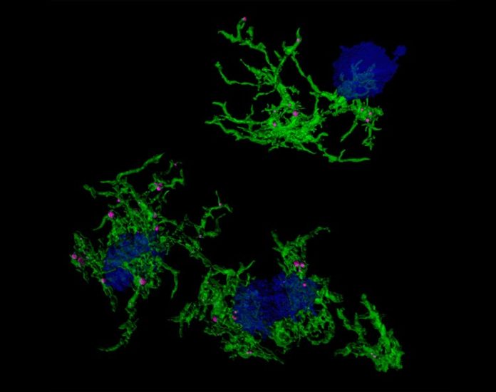 Imagen microscópica confocal de microglía (verde) que envuelve placas de amiloide (azul) en el Alzheimer