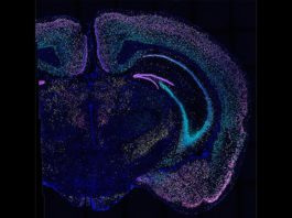 Técnica para mapear conexiones neuronales en el cerebro: BARseq2 BARseq2 detecta docenas de genes en miles de neuronas en este corte de cerebro de ratón. Cada color ilumina un conjunto diferente de genes