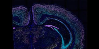 Técnica para mapear conexiones neuronales en el cerebro: BARseq2 BARseq2 detecta docenas de genes en miles de neuronas en este corte de cerebro de ratón. Cada color ilumina un conjunto diferente de genes