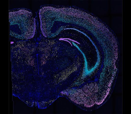 Técnica para mapear conexiones neuronales en el cerebro: BARseq2 BARseq2 detecta docenas de genes en miles de neuronas en este corte de cerebro de ratón. Cada color ilumina un conjunto diferente de genes