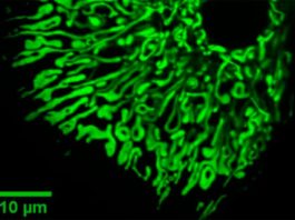 El bloqueo de una proteína en las células del hígado protege contra la resistencia a la insulina y la enfermedad del hígado graso Mitocondrias dentro de las células del hígado (hepatocitos)