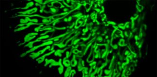 El bloqueo de una proteína en las células del hígado protege contra la resistencia a la insulina y la enfermedad del hígado graso Mitocondrias dentro de las células del hígado (hepatocitos)