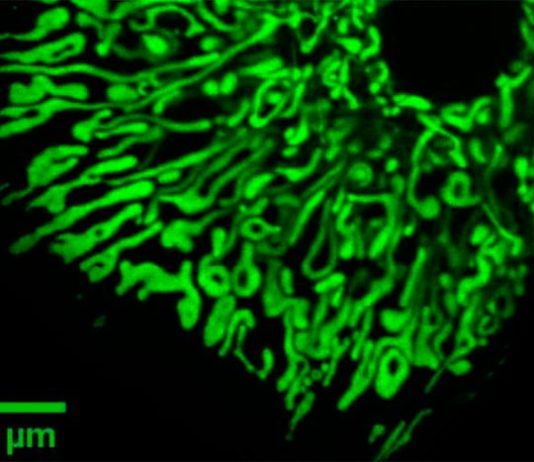 El bloqueo de una proteína en las células del hígado protege contra la resistencia a la insulina y la enfermedad del hígado graso Mitocondrias dentro de las células del hígado (hepatocitos)