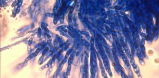 Reaniman un hongo de 70 años que mata el café para combatir una enfermedad de esta planta Esporas del hongo que causa la enfermedad del marchitamiento del café