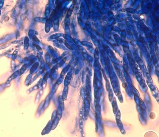 Reaniman un hongo de 70 años que mata el café para combatir una enfermedad de esta planta Esporas del hongo que causa la enfermedad del marchitamiento del café