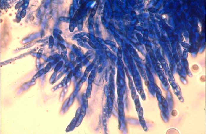 Esporas del hongo que causa la enfermedad del marchitamiento del café