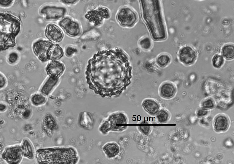 Partículas microfósiles de larga duración de plantas muertas llamadas fitolitos vistas bajo un microscopio