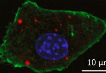 Nuevo diseño de nanopartículas para una mejor detección de tumores Una imagen de laboratorio muestraUna imagen de laboratorio muestra la detección de agentes de contraste de nanopartículas recientemente desarrolladas dentro de una célula de ratón con fluorescencia óptica (en rojo)