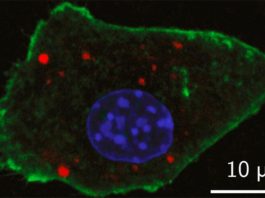 Nuevo diseño de nanopartículas para una mejor detección de tumores Una imagen de laboratorio muestraUna imagen de laboratorio muestra la detección de agentes de contraste de nanopartículas recientemente desarrolladas dentro de una célula de ratón con fluorescencia óptica (en rojo)