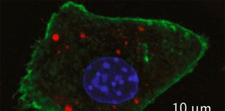 Nuevo diseño de nanopartículas para una mejor detección de tumores Una imagen de laboratorio muestraUna imagen de laboratorio muestra la detección de agentes de contraste de nanopartículas recientemente desarrolladas dentro de una célula de ratón con fluorescencia óptica (en rojo)