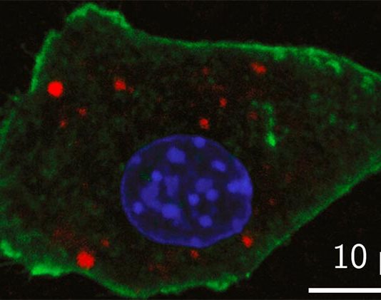 Nuevo diseño de nanopartículas para una mejor detección de tumores Una imagen de laboratorio muestraUna imagen de laboratorio muestra la detección de agentes de contraste de nanopartículas recientemente desarrolladas dentro de una célula de ratón con fluorescencia óptica (en rojo)