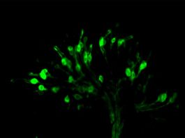 Sabor amargo: Según un estudio insectos y mamíferos utilizan similares clases de receptores del gusto Neuronas receptoras del gusto en las moscas (en verde) responsables de detectar ácidos en el entorno alimentario