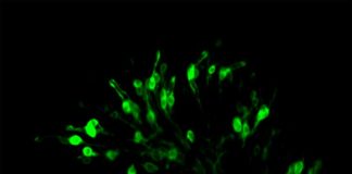 Sabor amargo: Según un estudio insectos y mamíferos utilizan similares clases de receptores del gusto Neuronas receptoras del gusto en las moscas (en verde) responsables de detectar ácidos en el entorno alimentario