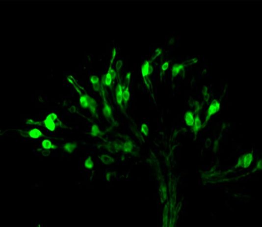Sabor amargo: Según un estudio insectos y mamíferos utilizan similares clases de receptores del gusto Neuronas receptoras del gusto en las moscas (en verde) responsables de detectar ácidos en el entorno alimentario