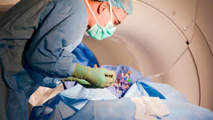 El Dr. James "Brad" Elder realiza una infusión cerebral de terapia génica en el Centro Médico Wexner de la Universidad Estatal de Ohio. En un nuevo estudio, la cirugía resultó en mejoras sin precedentes en los niños nacidos con un trastorno genético poco común: deficiencia de AADC El Dr. James "Brad" Elder realiza una infusión cerebral de terapia génica en el Centro Médico Wexner de la Universidad Estatal de Ohio. En un nuevo estudio, la cirugía resultó en mejoras sin precedentes en los niños nacidos con un trastorno genético poco común: deficiencia de AADC