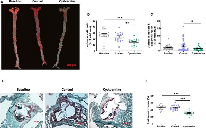 La cisteamina redujo la arterioesclerosis existente en ratones deficientes en receptores de lipoproteínas de baja densidad