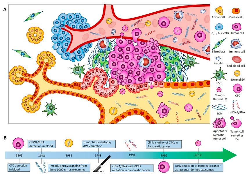 Adenocarcinoma ductal pancreático (PDAC) Adenocarcinoma ductal pancreático (PDAC)