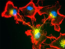 Las células inmunitarias del cerebro forman redes para proteger a las neuronas Los núcleos celulares (azul) pueden unirse mediante proyecciones tubulares (rojo) para degradar proteínas peligrosas en el cerebro, mediante la división del trabajo