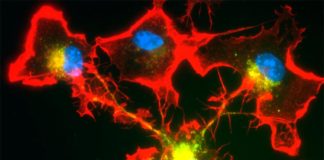 Las células inmunitarias del cerebro forman redes para proteger a las neuronas Los núcleos celulares (azul) pueden unirse mediante proyecciones tubulares (rojo) para degradar proteínas peligrosas en el cerebro, mediante la división del trabajo