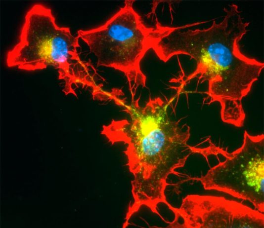 Las células inmunitarias del cerebro forman redes para proteger a las neuronas Los núcleos celulares (azul) pueden unirse mediante proyecciones tubulares (rojo) para degradar proteínas peligrosas en el cerebro, mediante la división del trabajo