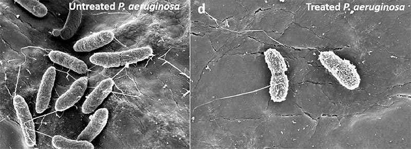 A la izquierda, una célula bacteriana de P. aeruginosa antes de la exposición al hidrogel dendrítico y luego mostrando un daño evidente