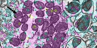 Las proteínas de larga vida en las mitocondrias del cerebro permiten a las neuronas vivir mucho tiempo Grupos de mitocondrias longevas en neuronas (envejecimiento)