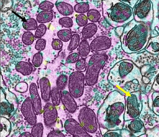 Las proteínas de larga vida en las mitocondrias del cerebro permiten a las neuronas vivir mucho tiempo Grupos de mitocondrias longevas en neuronas (envejecimiento)
