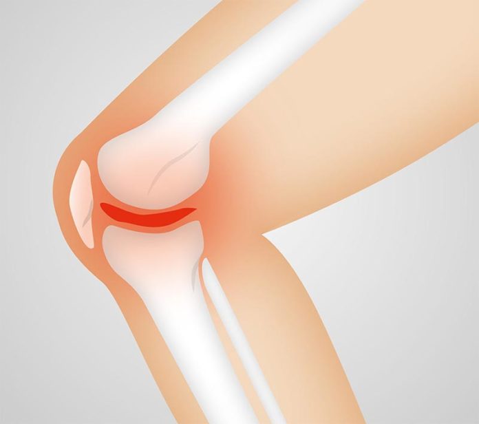 Osteoartritis Osteoartritis