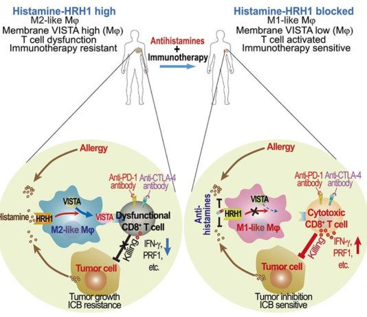 Los antihistamínicos pueden influir en la respuesta de la inmunoterapia al mejorar la activación de las células T Los antihistamínicos pueden influir en la respuesta de la inmunoterapia al mejorar la activación de las células T