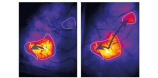 Ratones: El córtex del cerebro aprende a establecer conexiones sólo cuando son necesarias La activación de las áreas de la corteza del cerebro aumenta progresivamente durante el desarrollo posnatal de los ratones