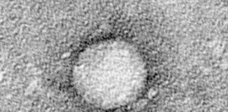 Telaprevir, el medicamento contra la hepatitis, aumenta la potencia de los antibióticos y limita la resistencia a los antibióticos Un medicamento aprobado para la hepatitis C puede aumentar la sensibilidad bacteriana a los antibióticos y reducir la probabilidad de resistencia a los antibióticos