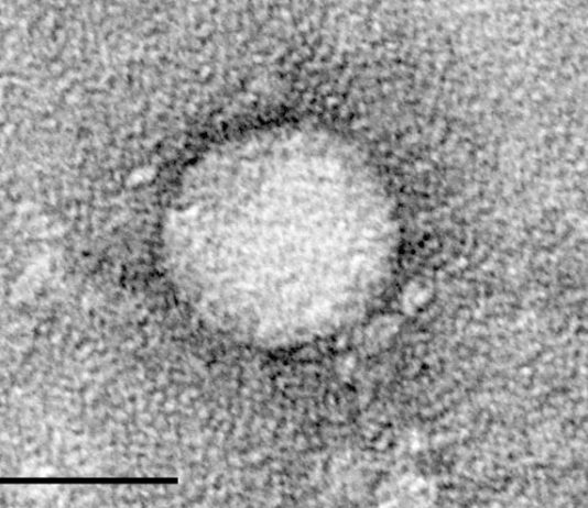 Telaprevir, el medicamento contra la hepatitis, aumenta la potencia de los antibióticos y limita la resistencia a los antibióticos Un medicamento aprobado para la hepatitis C puede aumentar la sensibilidad bacteriana a los antibióticos y reducir la probabilidad de resistencia a los antibióticos